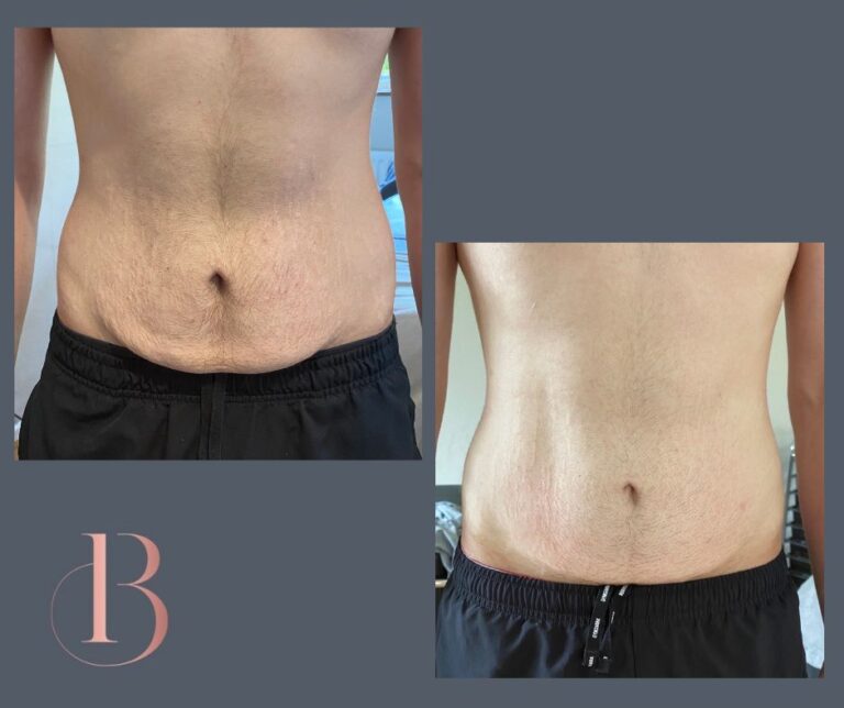 Jayden Before and After 768x644